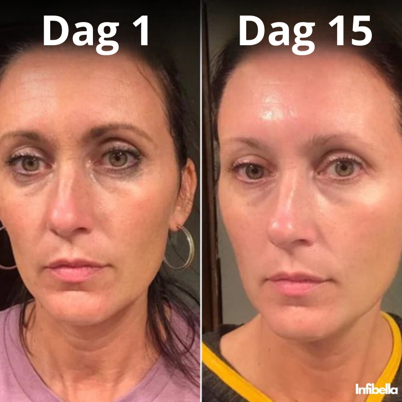 Infibella GlowBoost - Huidverjongende Crème