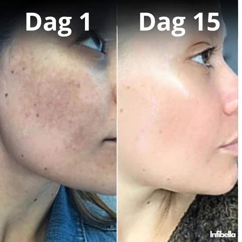 Infibella GlowBoost - Huidverjongende Crème