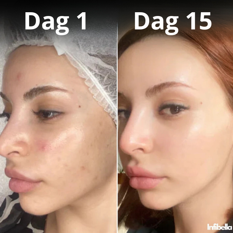 Infibella GlowBoost - Huidverjongende Crème
