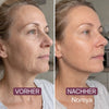 Nareya Collagen Lift — Piel firme y radiante.