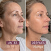 Nareya Collagen Lift — Piel firme y radiante.