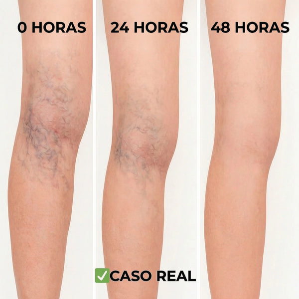 VeinPatch Parche Alivio Piernas Cansadas